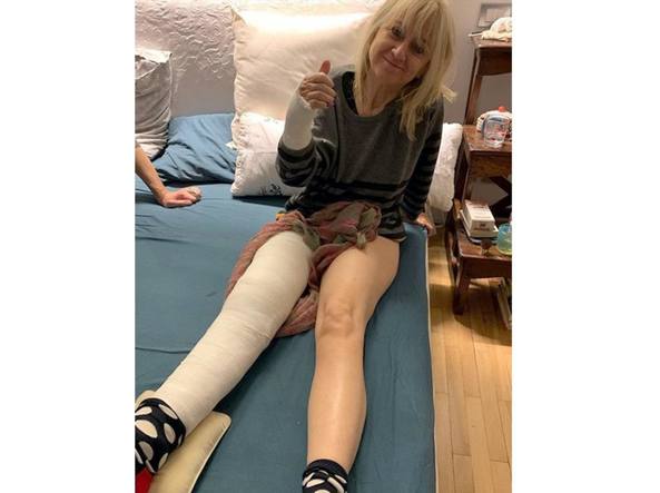 نشرت الممثلة الكوميدية صورة على إنستغرام تبين لها ملقاة على السرير مع ساقها وذراعها في الجبص.