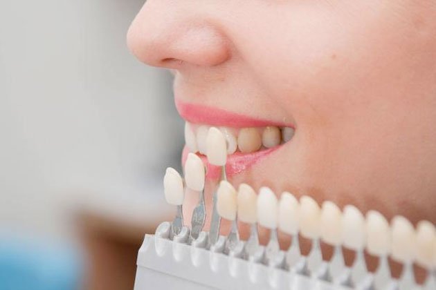 بورسلين - مجلة زوران