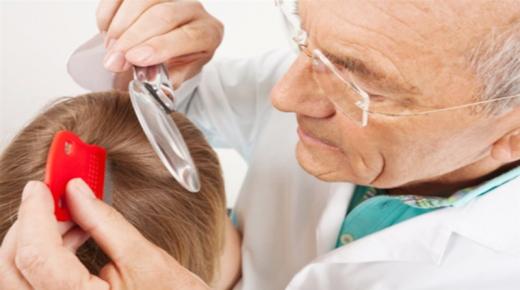 القمل في المدارس