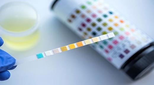 تحليل البول