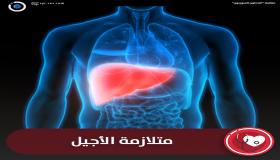 متلازمة الاجيل