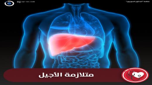 متلازمة الاجيل