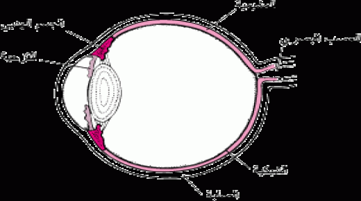 التهاب العنبية الأمامي