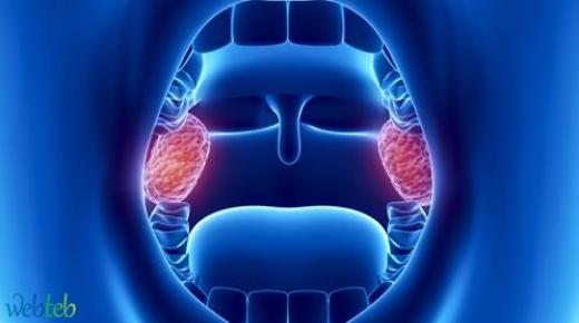 استئصال اللوزتين .