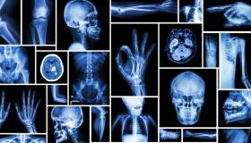 الأشعة السينية