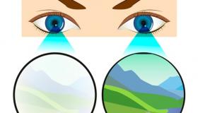 العين الكسولة