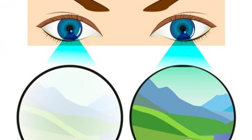 العين الكسولة