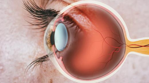 3 أمراض العيون التي قد تتطور بسبب مرض السكري وطرق العلاج.