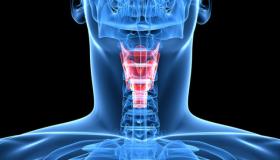 استئصال الحنجرة