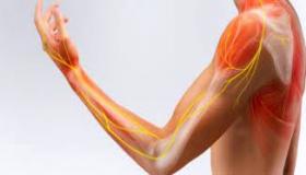 تصوير الأعصاب