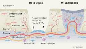 ما هو الجرح المفتوح؟