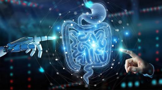 الذكاء الاصطناعي في مكافحة سرطان القولون