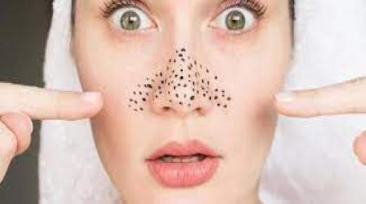 الرؤوس السوداء.