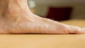 القدم المسطحة