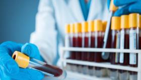 تحليل أنزيم الدم المناعي