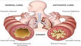 الربو مقابل مرض الانسداد الرئوي المزمن