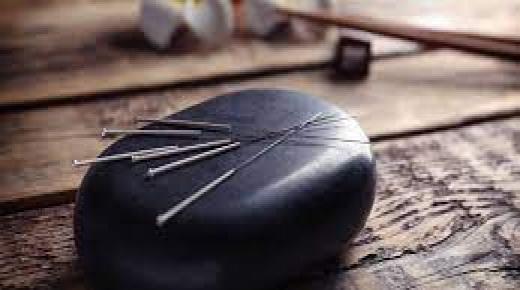 العلاج بالإبر