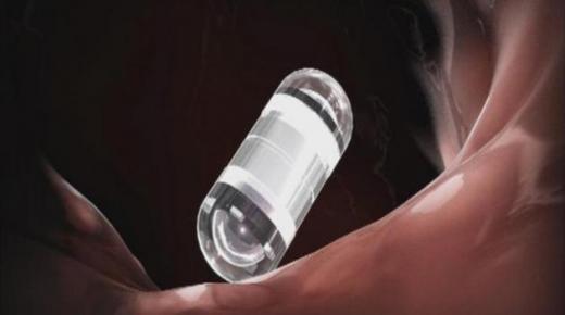 تنظير الكبسولة