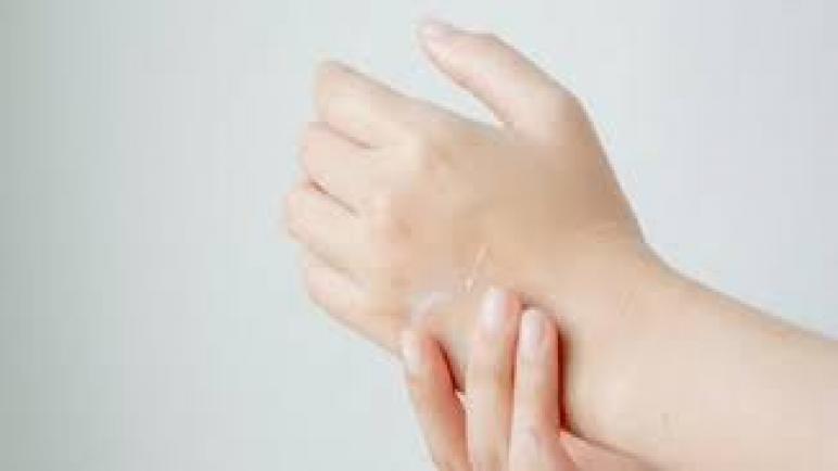 10 علاجات لجفاف اليدين