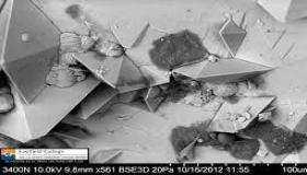 هذا ما تبدو عليه حصوات الكلى تحت المجهر