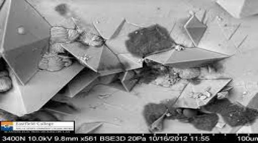 هذا ما تبدو عليه حصوات الكلى تحت المجهر