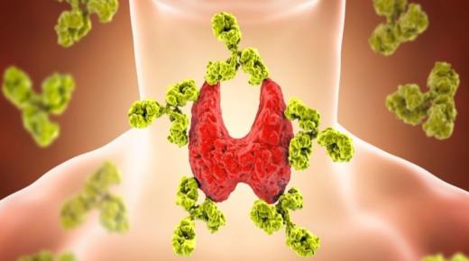 حمية هاشيموتو