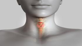 خمول الغدة الدرقية