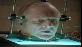 زراعة الرأس