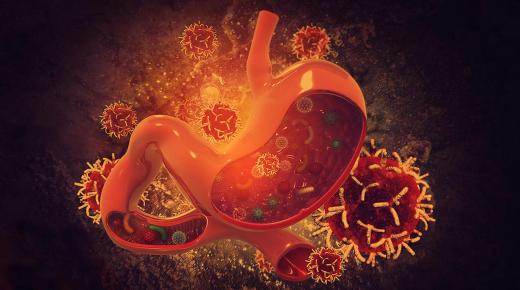 سرطان المعدة: ما هو “مفتاح” العلاج؟
