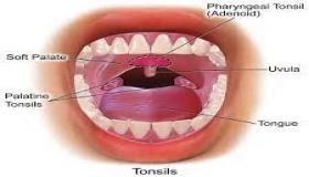 ما هو التهاب اللوزتين؟