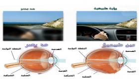 مد البصر (طول النظر)